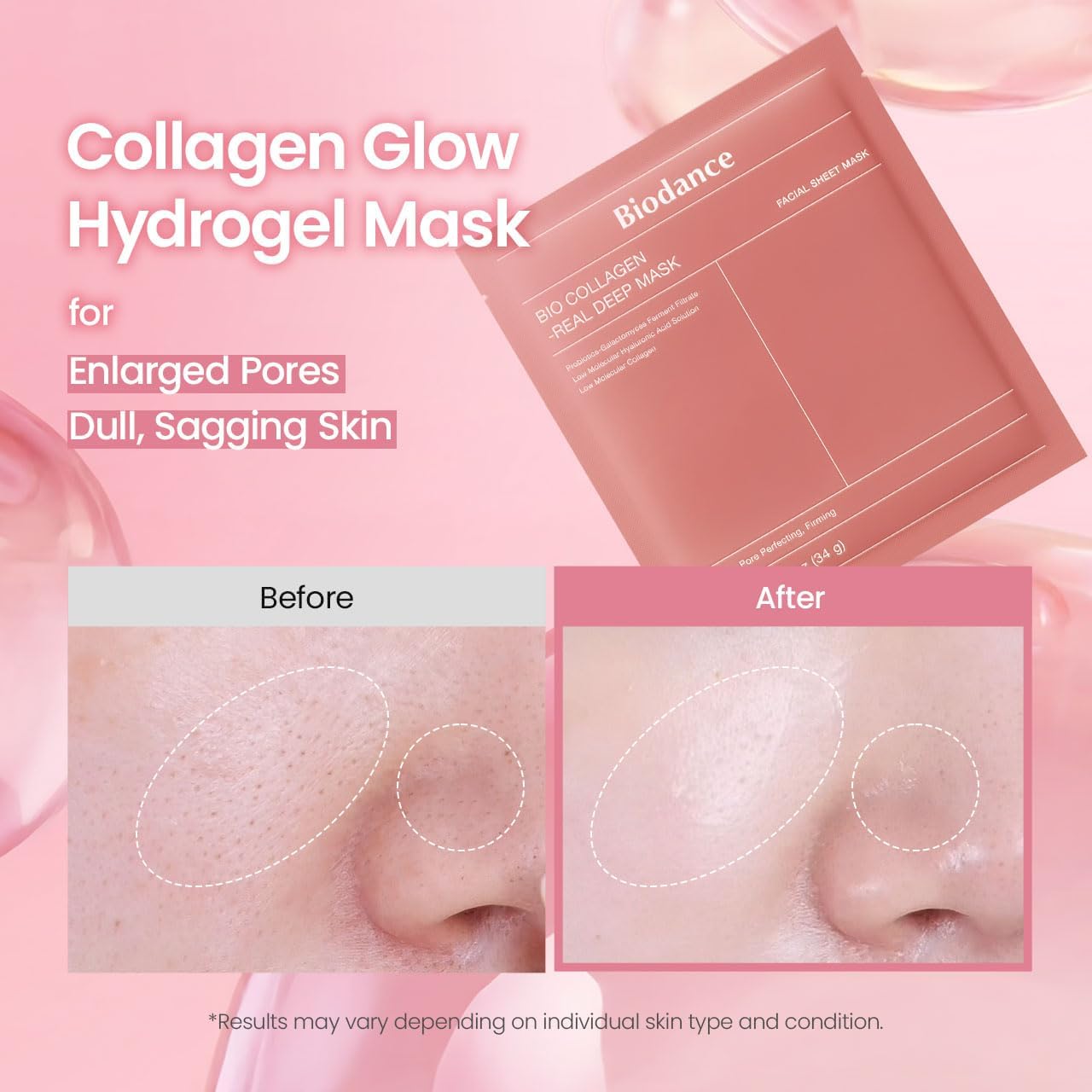 BIODANCE Bio-Collagen Real Deep Mask, Hydrogel Mask, Pore Minimizing, Elasticity Improvement, Korean Skincare | 1.19oz(34g