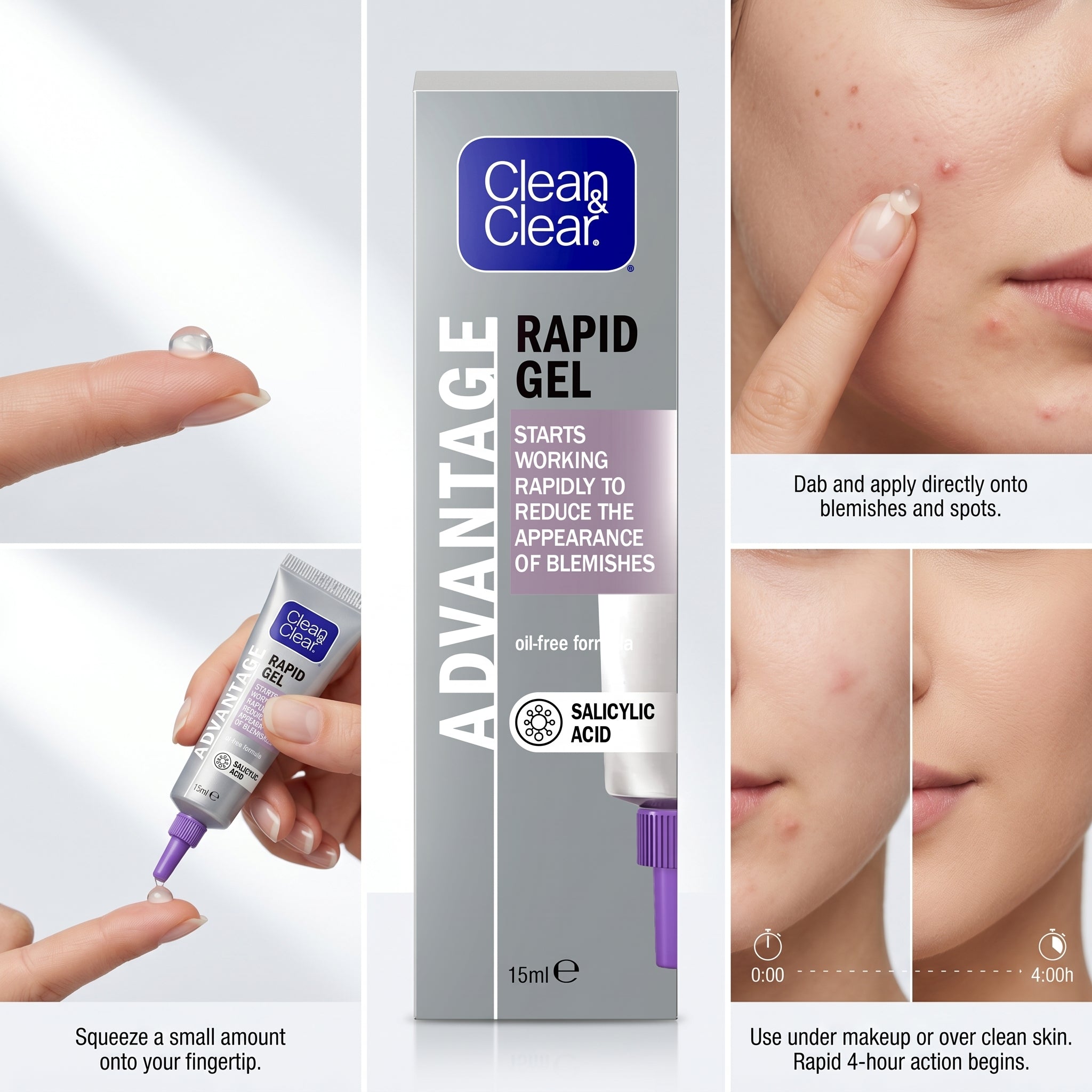 Clean & Clear Advantage Fast Action Spot Treatment Gel 15ml