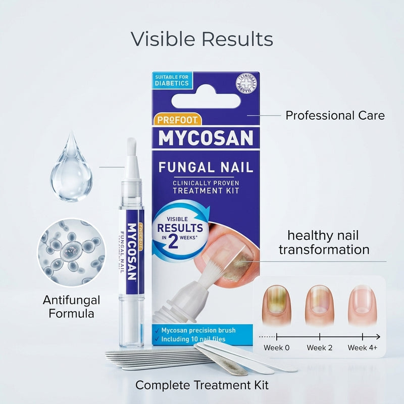 Profoot Mycosan Fungal Nail Treatment Kit